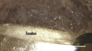 A tendon with the fascial sheet and network around it